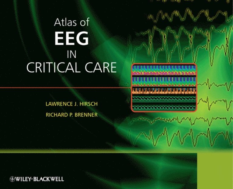 Richard P. Brenner, Lawrence J. Hirsch - Atlas of EEG in Critical Care, E-bok