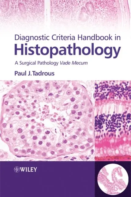 Paul J. Tadrous - Diagnostic Criteria Handbook in Histopathology, E-bok. Tillgänglighet: Lägg i varukorg