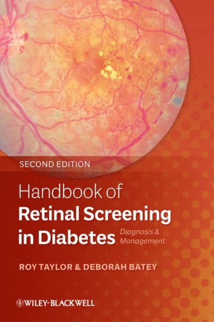 Deborah Batey, Roy Taylor - Handbook of Retinal Screening in Diabetes, E-bok. Tillgänglighet: Lägg i varukorg