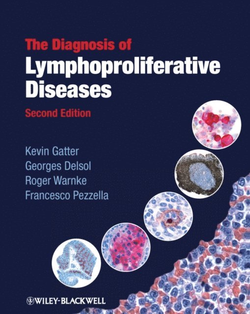 Francesco Pezzella, Roger Warnke, Georges Delsol, Kevin Gatter - Diagnosis of Lymphoproliferative Diseases, E-bok