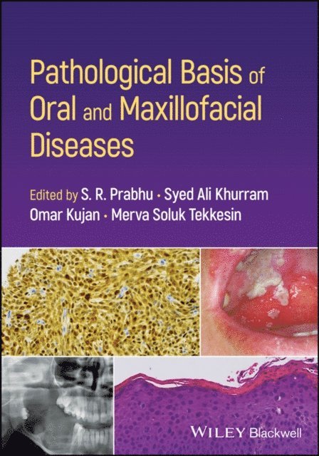 Merva Soluk Tekkesin, Omar Kujan, Syed Ali Khurram, S. R. Prabhu - Pathological Basis of Oral and Maxillofacial Diseases, E-bok