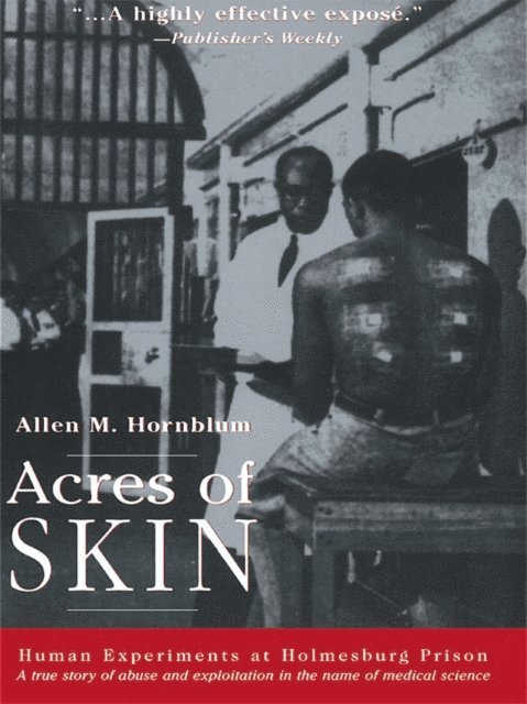 Allen M. Hornblum - Acres of Skin, E-bok. Tillgänglighet: Lägg i varukorg