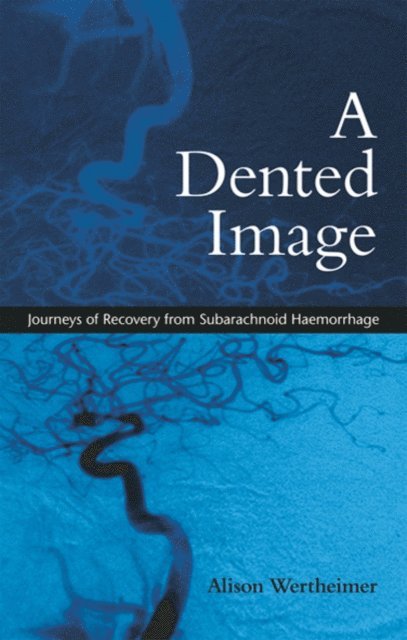 Alison Wertheimer - Dented Image, E-bok