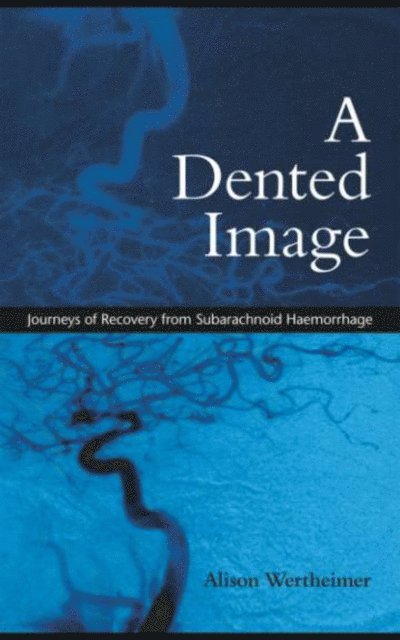 Alison Wertheimer - Dented Image, E-bok