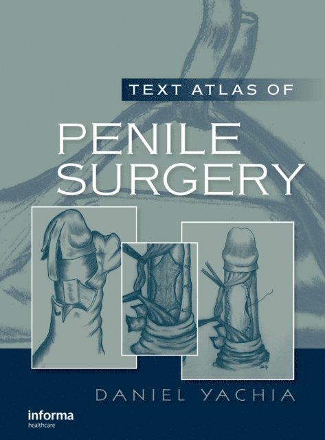 Daniel Yachia - Text Atlas of Penile Surgery, E-bok