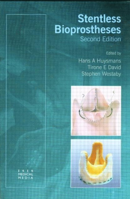 Tirone E David, Hans A Huysmans, Stephen Westaby - Stentless Bioprostheses, E-bok