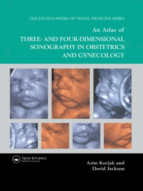 Asim Kurjak, David Jackson - Atlas of Three- and Four-Dimensional Sonography in Obstetrics and Gynecology, E-bok