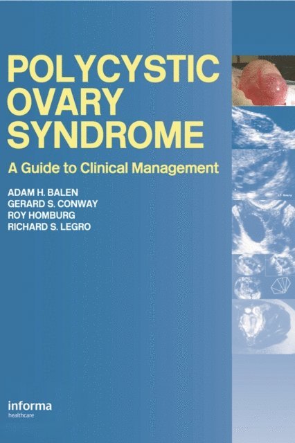 Richard Legro, Roy Homburg, Gerard Conway, Adam H. Balen - Polycystic Ovary Syndrome, E-bok