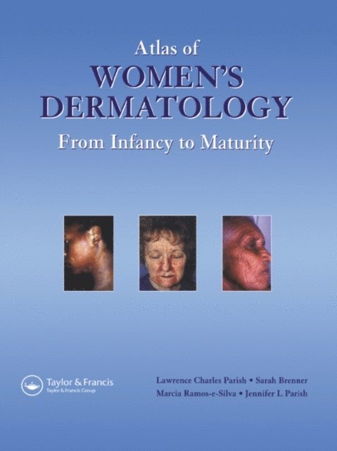 Jennifer L. Parish, Marcia Ramos e Silva, Sara Brenner, MD Lawrence Charles Parish - Atlas of Women's Dermatology, E-bok