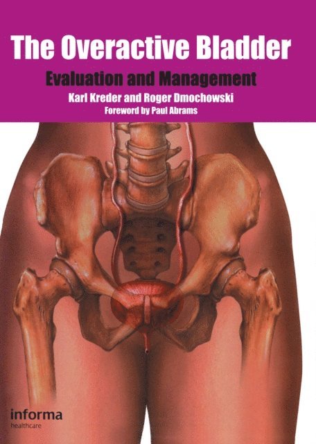 Roger Dmochowski, Karl Kreder - Overactive Bladder, E-bok
