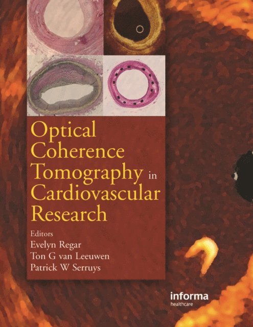 Patrick W. Serruys, A.M.G.J. van Leeuwen, Evelyn Regar - Optical Coherence Tomography in Cardiovascular Research, E-bok