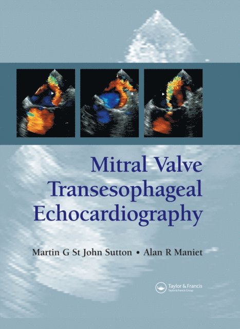 Alan R. Maniet, Martin G. St. John Sutton - Mitral Valve Transesophageal Echocardiography, E-bok