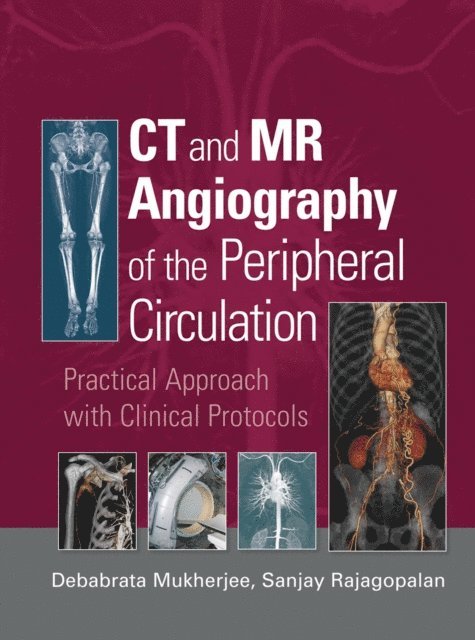Sanjay Rajagopalan, Debabrata Mukherjee - CT and MR Angiography of the Peripheral Circulation, E-bok