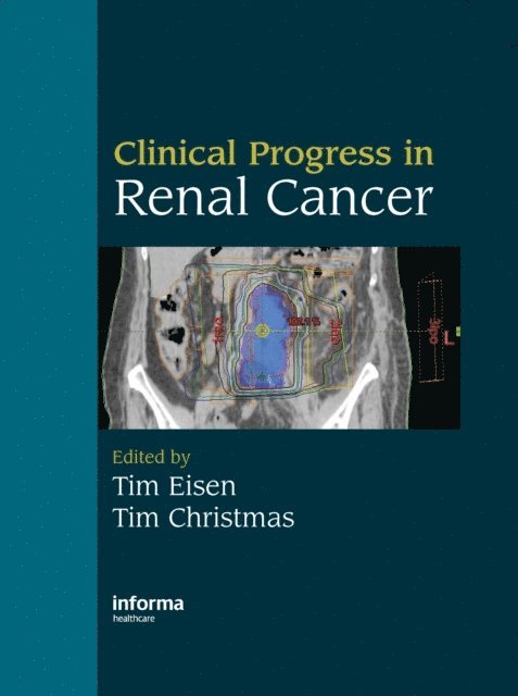 Tim Christmas, Tim Eisen - Clinical Progress in Renal Cancer, E-bok