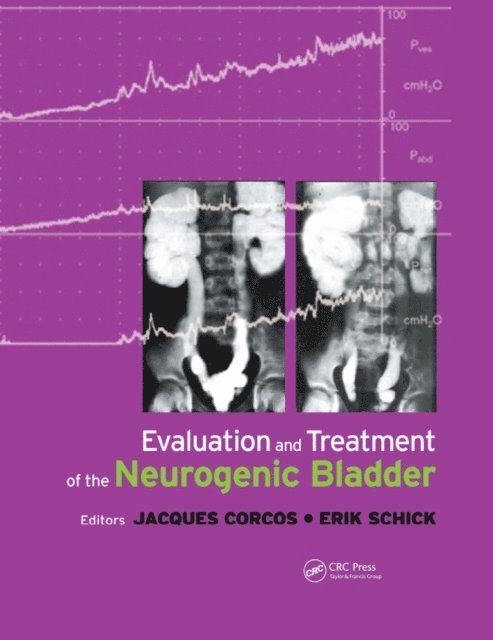 Eric Schick, Jacques Corcos - Evaluation and Treatment of the Neurogenic Bladder, E-bok