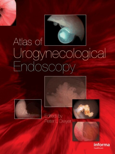 Peter L. Dwyer - Atlas of Urogynecological Endoscopy, E-bok