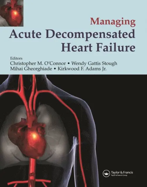 Kirkwood F. Adams, Miahai Gheorghiade, Wendy Gattis Stough, Christopher O'Connor - Management of Acute Decompensated Heart Failure, E-bok. Tillgänglighet: Lägg i varukorg