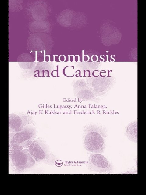 Frederick R. Rickles, Ajay K Kakkar, Anna Falanga, Gilles Lugassy - Thrombosis and Cancer, E-bok. Tillgänglighet: Lägg i varukorg