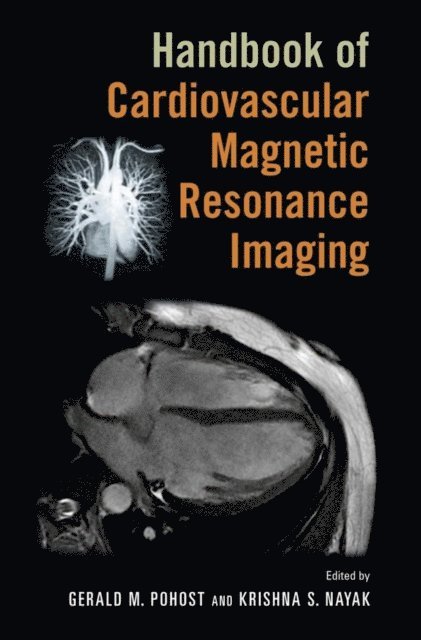 Krishna S. Nayak, Gerald M. Pohost - Handbook of Cardiovascular Magnetic Resonance Imaging, E-bok