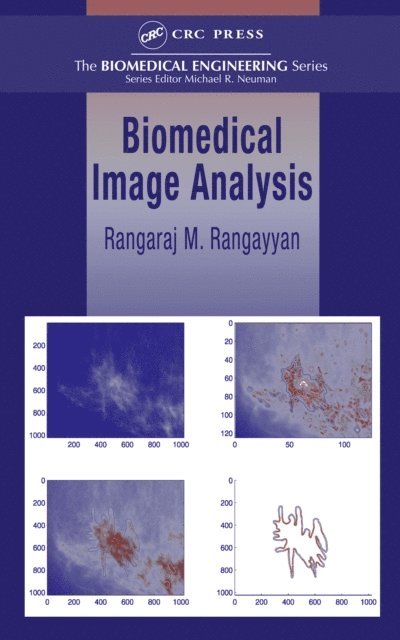 Rangaraj M. Rangayyan - Biomedical Image Analysis, E-bok