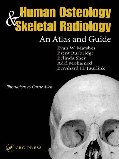 Bernard Juurlink, Evan W. Matshes - Human Osteology and Skeletal Radiology, E-bok