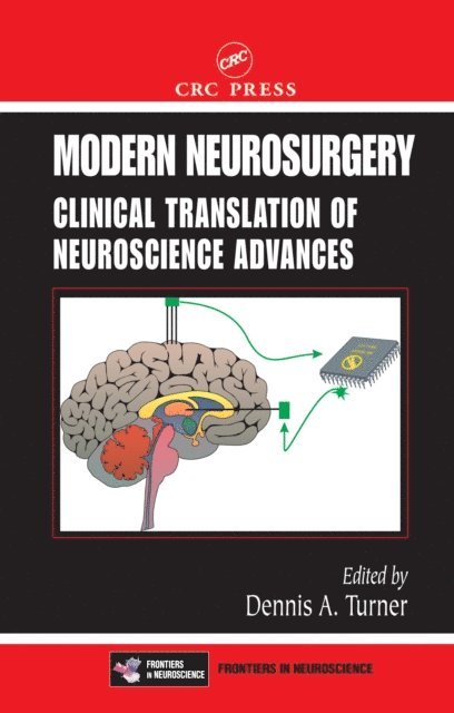 Dennis A. Turner - Modern Neurosurgery, E-bok