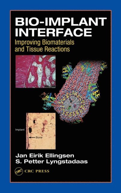 S.P. Lyngstadaas, J.E. Ellingsen - Bio-Implant Interface, E-bok