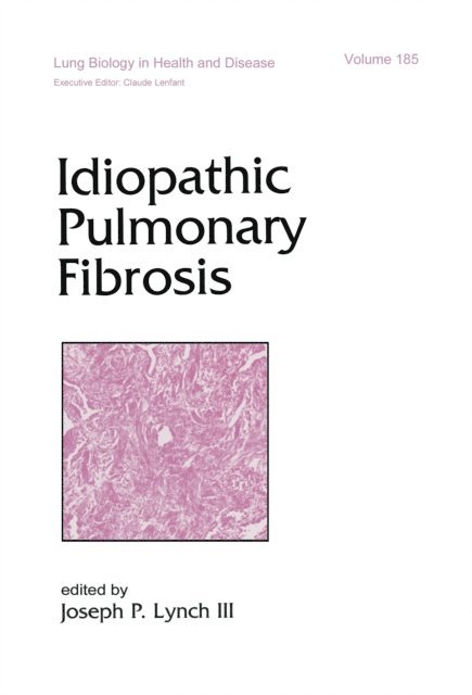 Joseph P. Lynch - Idiopathic Pulmonary Fibrosis, E-bok