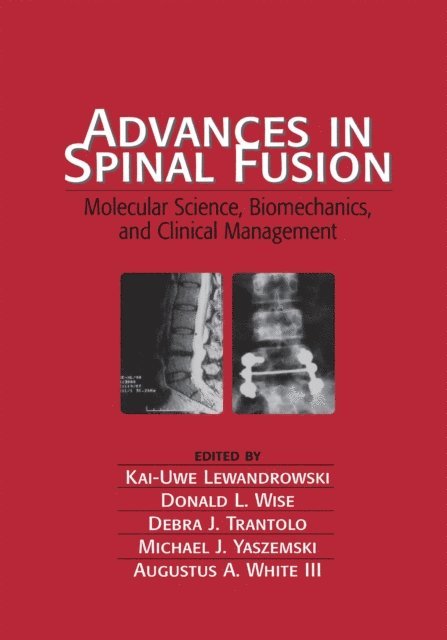 Kai-Uwe Lewandrowski - Advances in Spinal Fusion, E-bok