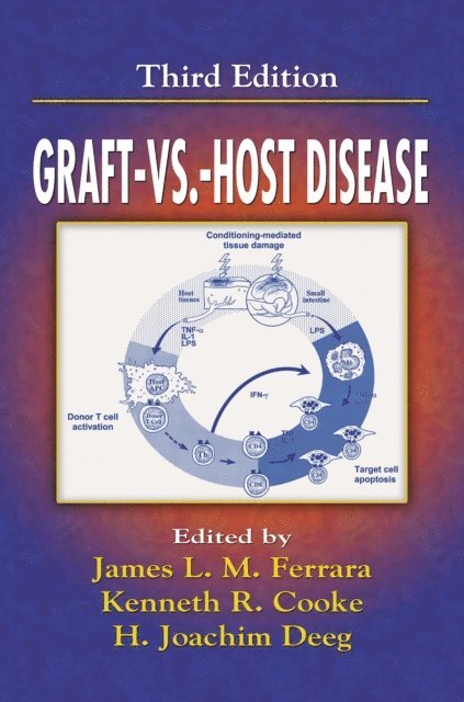 Kenneth R. Cooke, H. Joachim Deeg, James Ferrara - Graft vs. Host Disease, E-bok