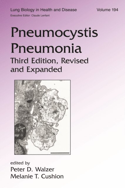 Melanie T. Cushion, Peter Walzer - Pneumocystis Pneumonia, E-bok