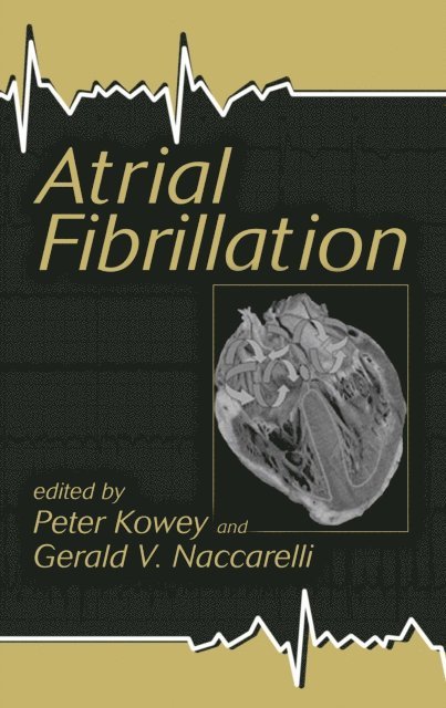 Gerald Naccarelli, Peter Kowey - Atrial Fibrillation, E-bok