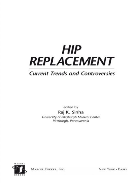 Raj K. Sinha - Hip Replacement, E-bok. Tillgänglighet: Lägg i varukorg