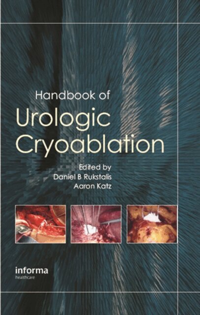 Aaron E. Katz, Daniel Rukstalis - Handbook of Urologic Cryoablation, E-bok