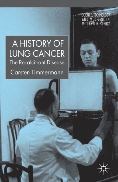 C. Timmermann - History of Lung Cancer, E-bok