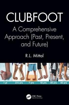 R. L. Mittal - Clubfoot, Inbunden. Tillgänglighet: Lägg i varukorg