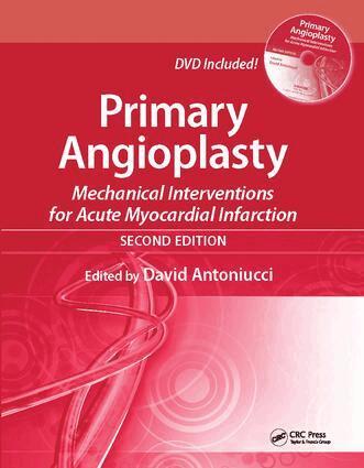 David Antoniucci - Primary Angioplasty, Häftad. Tillgänglighet: Lägg i varukorg