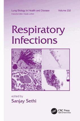 Sanjay Sethi - Respiratory Infections, Häftad. Tillgänglighet: Lägg i varukorg