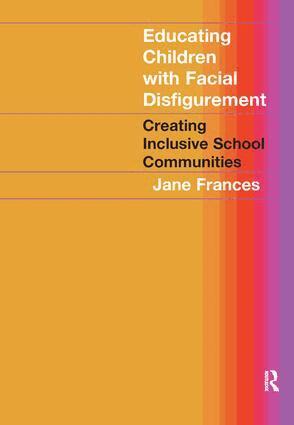 Jane Frances - Educating Children with Facial Disfigurement, Inbunden. Tillgänglighet: Lägg i varukorg