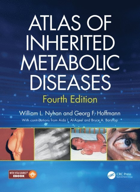 Georg F Hoffmann, William L Nyhan - Atlas of Inherited Metabolic Diseases, E-bok