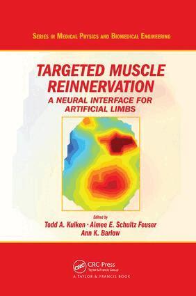 Todd A. Kuiken, Aimee E. Schultz Feuser, Ann K. Barlow - Targeted Muscle Reinnervation, Häftad. Tillgänglighet: Lägg i varukorg