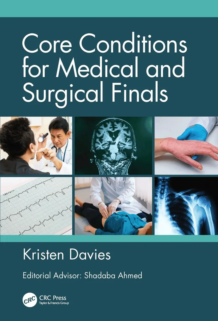Kristen Davies - Core Conditions for Medical and Surgical Finals, Inbunden. Tillgänglighet: Lägg i varukorg