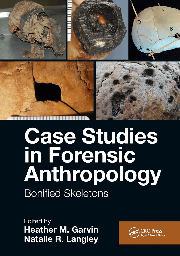 Heather M. Garvin, Natalie R. Langley - Case Studies in Forensic Anthropology, Inbunden
