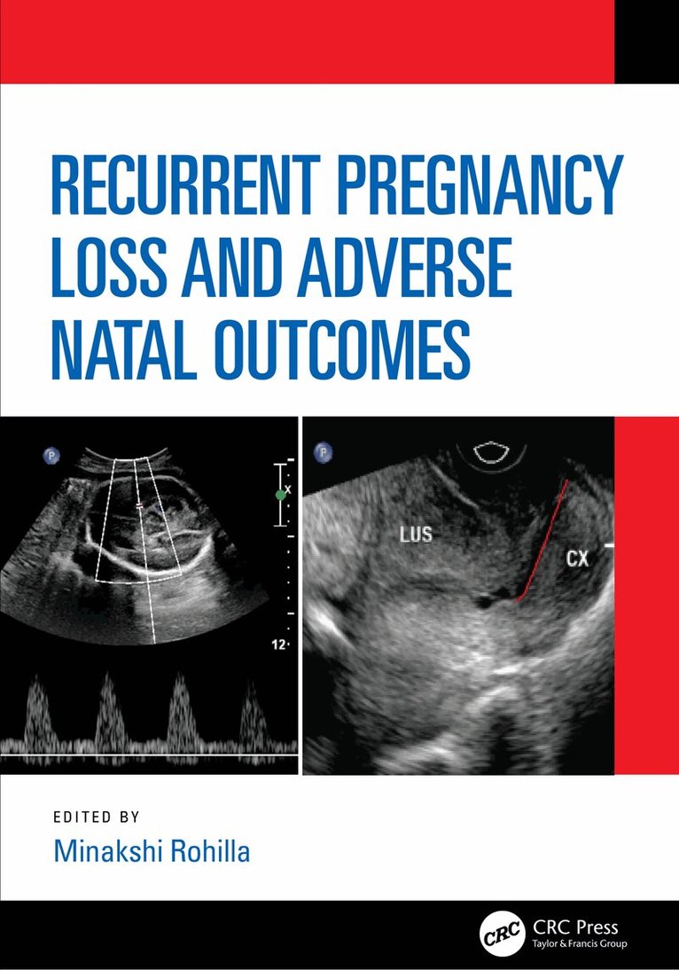 Minakshi Rohilla - Recurrent Pregnancy Loss and Adverse Natal Outcomes, Inbunden