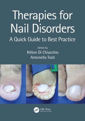 Therapies for Nail Disorders av Nilton Di Chiacchio, Antonella Tosti, Nilton Di Chiacchio