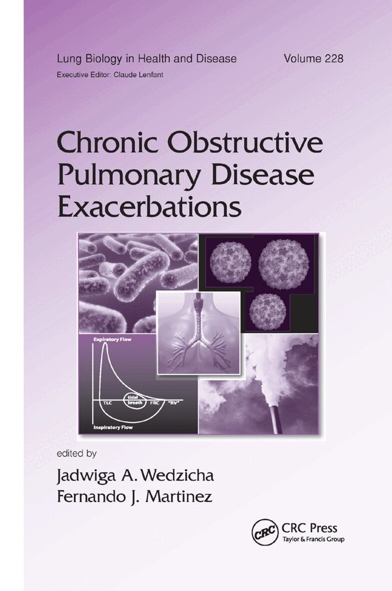 Jadwiga A. Wedzicha, Fernando J. Martinez - Chronic Obstructive Pulmonary Disease Exacerbations, Häftad