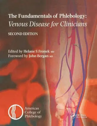 Helane S Fronek - Fundamentals of Phlebology: Venous Disease for Clinicians, Inbunden. Tillgänglighet: Lägg i varukorg