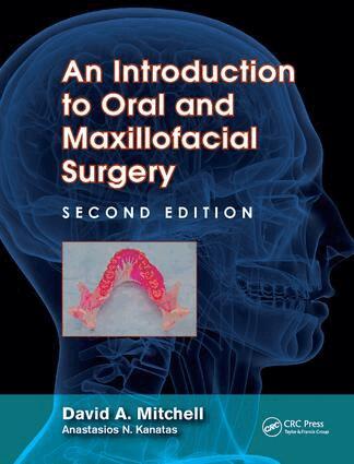 David A. Mitchell, Anastasios Kanatas - Introduction to Oral and Maxillofacial Surgery, Inbunden