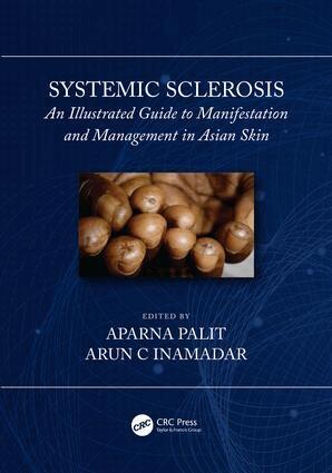 Arun C Inamadar, Aparna Palit - Systemic Sclerosis, Inbunden. Tillgänglighet: Lägg i varukorg