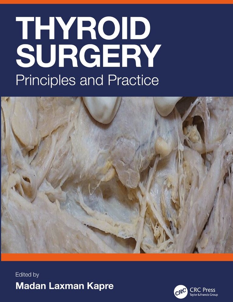 Madan Kapre - Thyroid Surgery, Inbunden